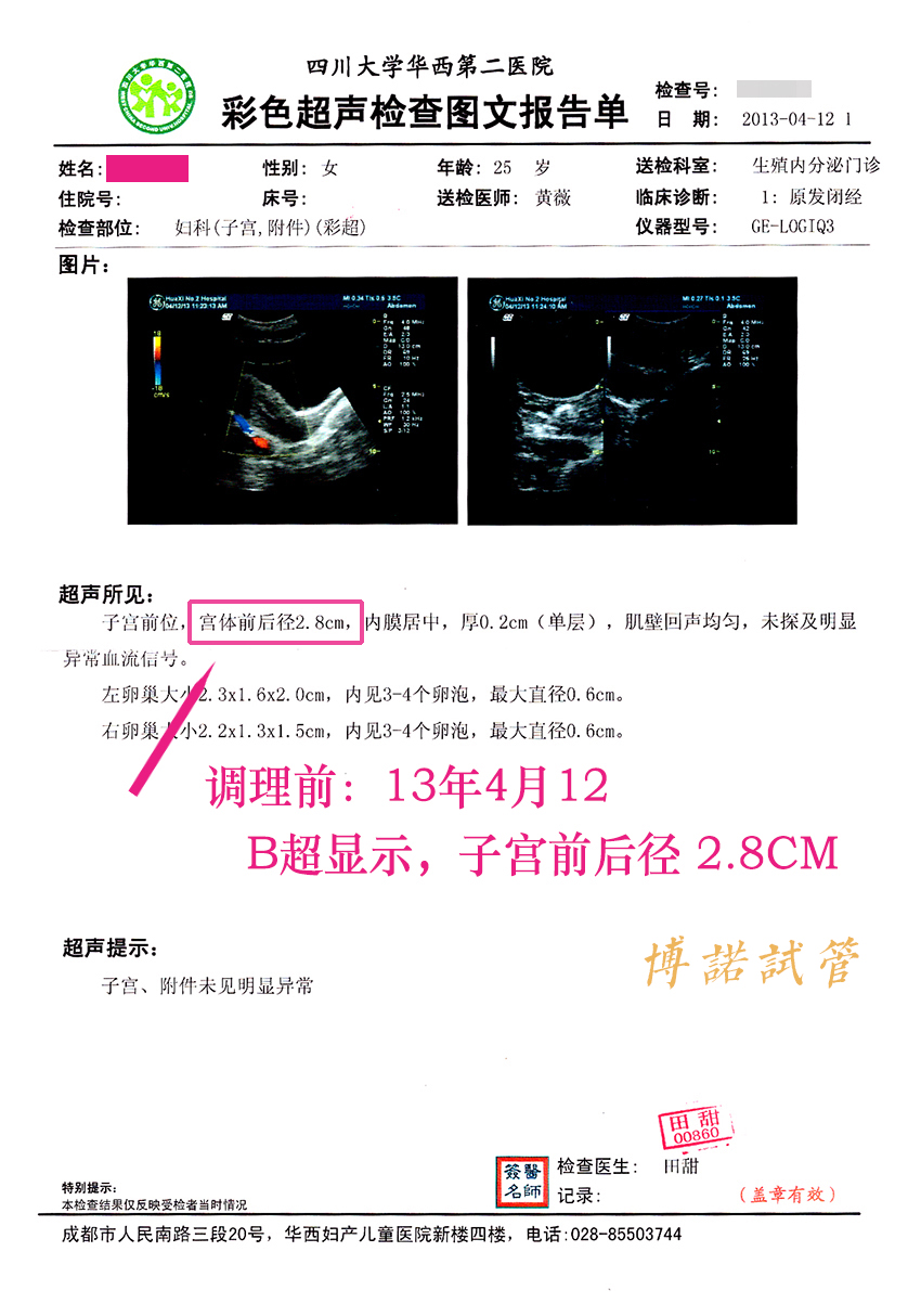 德国代孕机构排名.jpg