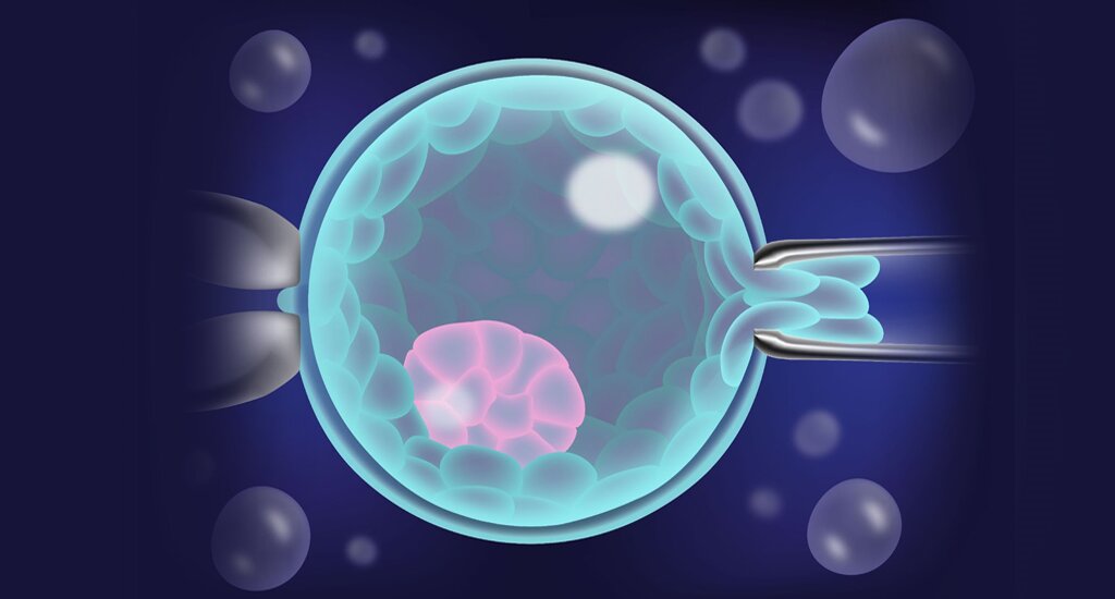 ​北京代孕机构：​​那些年，我在试管移植中流过的泪：终于，等来了我的小天使