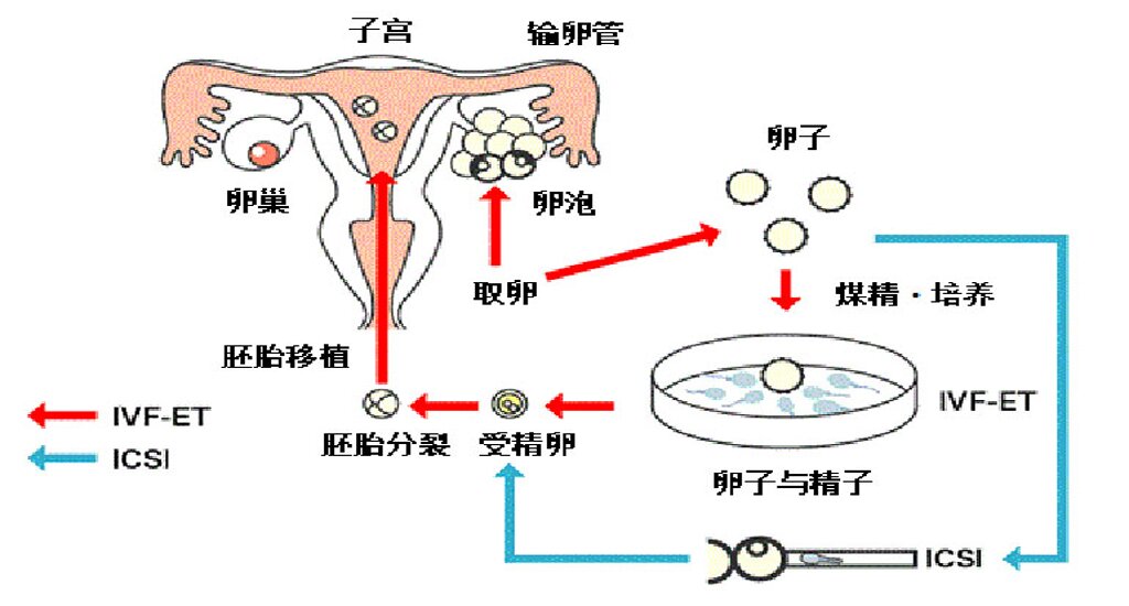 北京代孕机构：我的“幸孕”不是“奇迹”